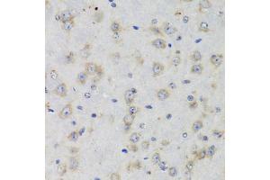 Immunohistochemistry of paraffin-embedded rat brain using ISG15 Antibody (ABIN5970528) at dilution of 1/100 (40x lens). (ISG15 Antikörper)