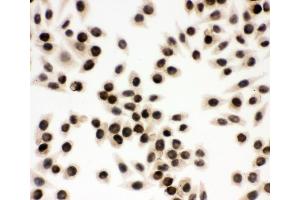 IHC analysis of EWSR1 using anti-EWSR1 antibody (ABIN3043825).