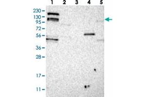 Western blot analysis of Lane 1: RT-4, Lane 2: U-251 MG, Lane 3: Human Plasma, Lane 4: Liver, Lane 5: Tonsil with ARHGEF10L polyclonal antibody .