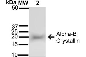 Western blot analysis of Rat Brain cell lysates showing detection of ~22 kDa Alpha B Crystallin protein using Rabbit Anti-Alpha B Crystallin Polyclonal Antibody (ABIN361836 and ABIN361837). (CRYAB Antikörper)