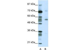 WB Suggested Anti-CORO1A Antibody Titration:  2. (Coronin 1a Antikörper  (N-Term))