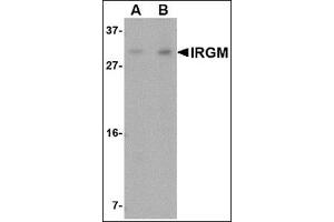Western blot analysis of IRGM in Rat brain lysate with this product at (A) 1 and (B) 2 μg/ml.