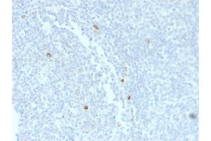 Formalin-fixed, paraffin-embedded human Tonsil stained with IgM Mouse Recombinant Monoclonal Antibody (rIM373). (Rekombinanter IGHM Antikörper)