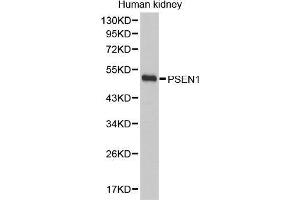 Western Blotting (WB) image for anti-Presenilin 1 (PSEN1) (AA 1-160) antibody (ABIN3023160) (Presenilin 1 Antikörper  (AA 1-160))