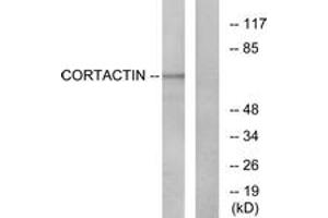 Western blot analysis of extracts from HeLa cells, treated with H2O2, using Cortactin (Ab-421) Antibody. (Cortactin Antikörper  (AA 388-437))