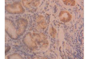 IHC-P analysis of Human Stomach Tissue, with DAB staining. (ANGPTL2 Antikörper  (AA 267-493))