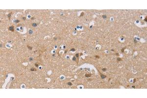 Immunohistochemistry of paraffin-embedded Human brain using FXYD1 Polyclonal Antibody at dilution of 1:60 (FXYD1 Antikörper)