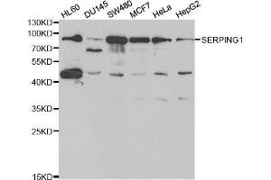 Western blot analysis of extracts of various cell lines, using SERPING1 antibody. (SERPING1 Antikörper  (AA 201-500))
