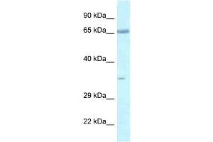 WB Suggested Anti-Lzts1 Antibody   Titration: 1.