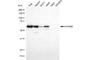 Western blotting analysis using PTPN6 antibody (ABIN7800046).