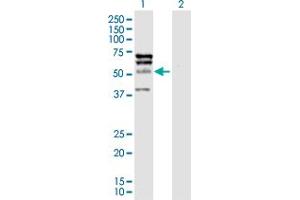 Western Blot analysis of ELK4 expression in transfected 293T cell line by ELK4 MaxPab polyclonal antibody. (ELK4 Antikörper  (AA 1-405))
