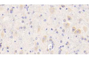 Immunohistochemistry (IHC) image for anti-Amyloid beta (A4) Precursor Protein (APP) (AA 18-286) antibody (ABIN7436888)