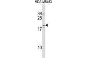 Western blot analysis in MDA-MB453 cell line lysates (35ug/lane) using NKAIN2  Antibody . (NKAIN2 Antikörper  (Middle Region))