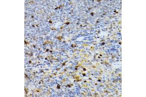 Immunohistochemistry (IHC) image for anti-serpin Peptidase Inhibitor, Clade B (Ovalbumin), Member 1 (SERPINB1) (AA 100-379) antibody (ABIN6147583)