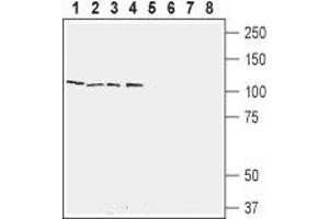Western blot analysis of rat brain (lanes 1 and 5), rat testis (lanes 2 and 6), mouse brain (lanes 3 and 7) and mouse testis (lanes 4 and 8): - 1-4.