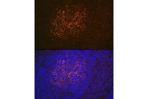 Immunofluorescence analysis of rat spleen using CR2/CD21 Rabbit mAb (ABIN1678995, ABIN3015431, ABIN3015432 and ABIN7101406) at dilution of 1:100 (40x lens). (CD21 Antikörper)