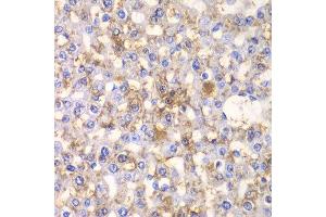 Immunohistochemistry of paraffin-embedded rat liver using HAPLN1 antibody at dilution of 1:100 (x40 lens). (HAPLN1 Antikörper)