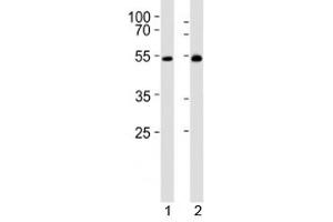 Western Blotting (WB) image for anti-Lymphocyte-Specific Protein tyrosine Kinase (LCK) (AA 23-52) antibody (ABIN3031644)