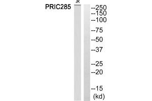 Western blot analysis of extracts from Jurkat cells, using PRIC285 antibody. (HELZ2 Antikörper  (Internal Region))