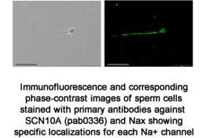 Image no. 1 for anti-Sodium Channel, Voltage-Gated, Type X, alpha Subunit (SCN10A) (C-Term) antibody (ABIN347335)