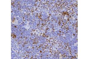 IHC analysis of Cdc25b using anti-Cdc25b antibody (ABIN7599793).