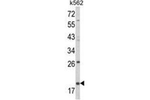 Western blot analysis of KLRD1 Antibody (N-term) in K562 cell line lysates (35ug/lane). (CD94 Antikörper  (N-Term))