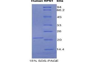 SDS-PAGE analysis of Human Ribophorin I Protein. (RPN1 Protein)