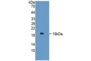 Detection of Recombinant HBa1, Mouse using Polyclonal Antibody to Hemoglobin Alpha 1 (HBa1) (HBA1 Antikörper  (AA 1-142))