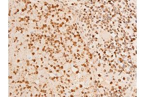 ABIN6267251 at 1/100 staining human TB tissue sections by IHC-P. (CHEK2 Antikörper  (pThr383))