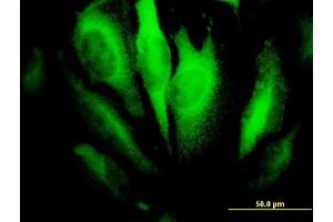 Immunofluorescence of monoclonal antibody to RHOA on HeLa cell. (RHOA Antikörper  (AA 1-193))