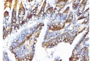 IHC analysis of EIF5A using anti-EIF5A antibody (ABIN7602568).
