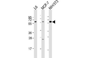 All lanes : Anti-YES1 Antibody (N-term) at 1:2000 dilution Lane 1: L6 whole cell lysates Lane 2: MCF-7 whole cell lysates Lane 3: NIH/3T3 whole cell lysates Lysates/proteins at 20 μg per lane. (YES1 Antikörper  (N-Term))