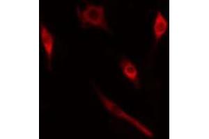 ABIN6274985 staining  HT29 cells by IF/ICC. (CRABP2 Antikörper  (Internal Region))