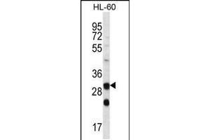 Western blot analysis in HL-60 cell line lysates (35ug/lane). (CA6 Antikörper  (C-Term))