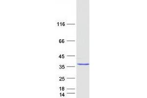 Validation with Western Blot (ANKRD49 Protein (Myc-DYKDDDDK Tag))