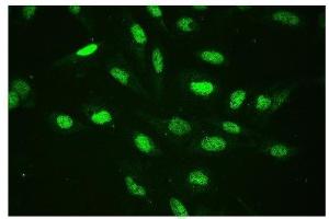 IF analysis of CTBP2 using anti-CTBP2 antibody (ABIN3042768).