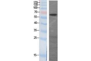 Western Blotting (WB) image for anti-GAD65+GAD67 (C-Term) antibody (ABIN3175202) (GAD65+GAD67 (C-Term) Antikörper)