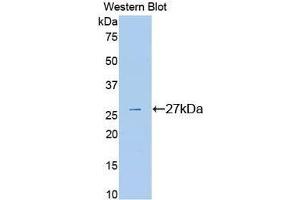 Western Blotting (WB) image for anti-Plasminogen (PLG) (AA 582-812) antibody (ABIN3207025) (PLG Antikörper  (AA 582-812))