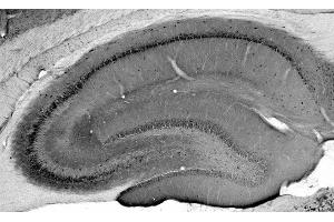 Adult rat hippocampus immunohistochemistry. (Neuroligin 1 Antikörper  (C-Term, Intracellular))