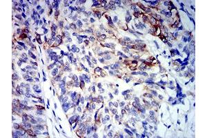 Immunohistochemistry (IHC) image for anti-Fc Fragment of IgG, High Affinity Ia, Receptor (CD64) (FCGR1A) (AA 16-145) antibody (ABIN5684135)