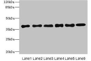 Western blot All lanes: TMEM68 antibody at 4 μg/mL Lane 1: Mouse thymus tissue Lane 2: K562 whole cell lysate Lane 3: U251 whole cell lysate Lane 4: HepG2 whole cell lysate Lane 5: MCF-7 whole cell lysate Lane 6: Jurkat whole cell lysate Secondary Goat polyclonal to rabbit IgG at 1/10000 dilution Predicted band size: 38, 30, 16 kDa Observed band size: 38 kDa