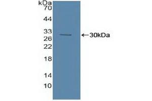 Detection of Recombinant ASM, Human using Polyclonal Antibody to Acid Sphingomyelinase (ASM) (SMPD1 Antikörper  (AA 319-579))