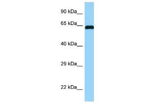 WB Suggested Anti-ABI1 Antibody Titration: 1. (ABI1 Antikörper  (N-Term))