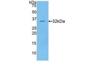 Detection of Recombinant PKCh, Human using Polyclonal Antibody to Protein Kinase C Eta (PKCh) (PKC eta Antikörper  (AA 355-614))