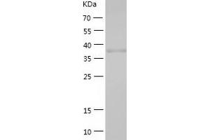 Western Blotting (WB) image for Napsin A Aspartic Peptidase (NAPSA) (AA 64-420) protein (His tag) (ABIN7284790) (NAPSA Protein (AA 64-420) (His tag))