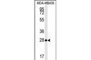 MRM1 Antibody (N-term) (ABIN654341 and ABIN2844111) western blot analysis in MDA-M cell line lysates (35 μg/lane). (MRM1 Antikörper  (N-Term))