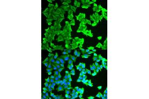 Immunofluorescence analysis of HeLa cells using RPLP0 antibody. (RPLP0 Antikörper)