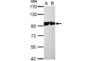 Exportin 2 Antikörper  (Center)