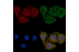 ABIN6257806 and ABIN6275277 staining Hela cells(45 min of heat-shock) by IF/ICC. (CYB5R1 Antikörper  (C-Term))