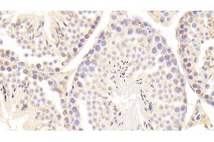 Detection of GAS6 in Mouse Testis Tissue using Polyclonal Antibody to Growth Arrest Specific Protein 6 (GAS6) (GAS6 Antikörper  (AA 483-646))